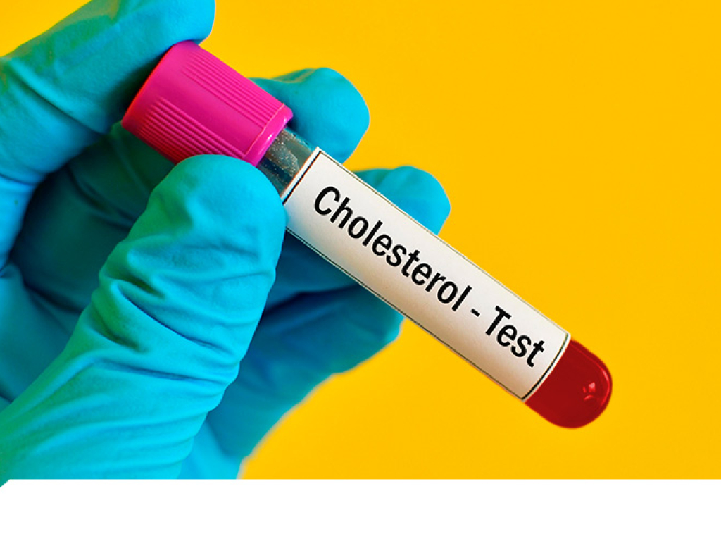 Guía Definitiva Colesterol